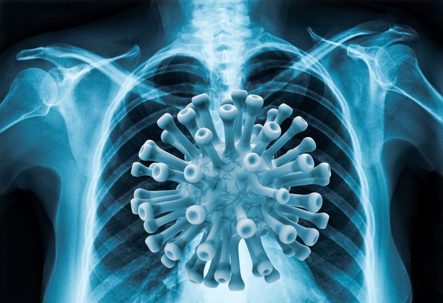 coronavirus covid-19 poumons